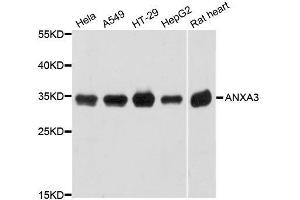 Western blot analysis of extracts of various cell lines, using ANXA3 antibody. (Annexin A3 anticorps  (AA 1-323))