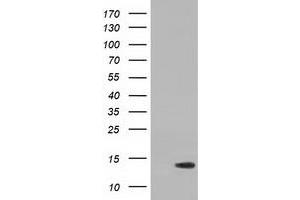 HEK293T cells were transfected with the pCMV6-ENTRY control (Left lane) or pCMV6-ENTRY RIPPLY2 (Right lane) cDNA for 48 hrs and lysed. (RIPPLY2 anticorps)