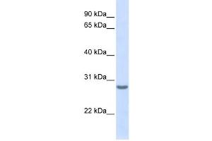 Western Blotting (WB) image for anti-Tetraspanin 6 (TSPAN6) antibody (ABIN2458934) (Tetraspanin 6 anticorps)