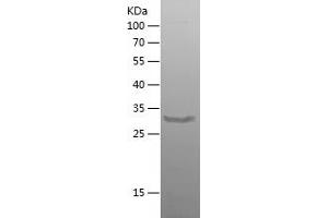 Western Blotting (WB) image for Axin 2 (AXIN2) (AA 579-843) protein (His tag) (ABIN7121955)