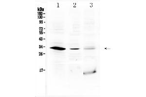 Western blot analysis of HOXB1 using anti-HOXB1 antibody . (HOXB1 anticorps  (C-Term))