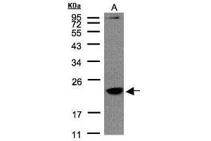 WB Image Sample(30 μg of whole cell lysate) A:Raji, 12% SDS PAGE antibody diluted at 1:1500 (TMEM147 anticorps)