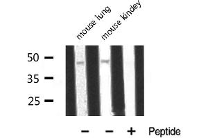 Western blot analysis of ADA2L expression in various lysates