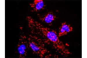 Proximity Ligation Analysis of protein-protein interactions between TBL1X and CTNNB1.