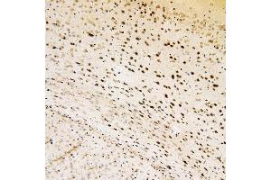 IHC analysis of SOX15 using anti-SOX15 antibody (ABIN6719624). (SOX15 anticorps  (AA 1-233))