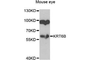 Western blot analysis of extracts of mouse eye, using KRT6B antibody (ABIN2737066) at 1:1000 dilution. (Keratin 6B anticorps)