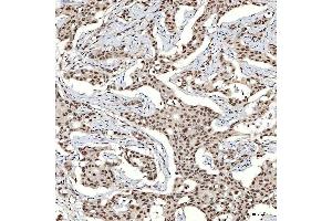 IHC analysis of SNRNP40 using anti-SNRNP40 antibody (ABIN7601719). (SNRNP40 anticorps  (AA 43-357))