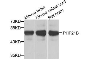 anti-PHD Finger Protein 21B (PHF21B) antibody
