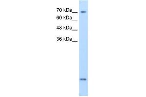 WB Suggested Anti-SLC6A8 Antibody Titration:  2. (SLC6A8 anticorps  (N-Term))