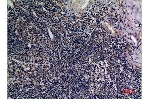 Immunohistochemistry (IHC) analysis of paraffin-embedded Human Tonsils, antibody was diluted at 1:100. (BAFF anticorps  (Internal Region))