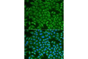 Immunofluorescence analysis of U2OS cells using PIP antibody (ABIN6131693, ABIN6145670, ABIN6145672 and ABIN6222022).