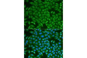 Immunofluorescence analysis of U2OS cells using PIP antibody (ABIN6131693, ABIN6145670, ABIN6145672 and ABIN6222022). (PIP anticorps  (AA 29-146))