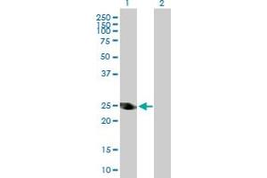 Western Blot analysis of ADH6 expression in transfected 293T cell line by ADH6 MaxPab polyclonal antibody.