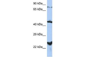 WB Suggested Anti-MRS2L Antibody Titration:  0. (MRS2 anticorps  (Middle Region))