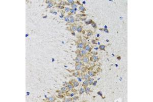 Immunohistochemistry of paraffin-embedded rat brain using CDK1 antibody. (CDK1 anticorps)