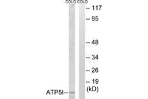 Western Blotting (WB) image for anti-ATP Synthase, H+ Transporting, Mitochondrial F0 Complex, Subunit E (ATP5I) (AA 20-69) antibody (ABIN2890139) (ATP5I anticorps  (AA 20-69))