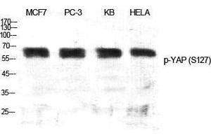Western Blot (WB) analysis of specific cells using Phospho-YAP (S127) Polyclonal Antibody. (YAP1 anticorps  (pSer127))