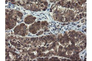Immunohistochemistry (IHC) image for anti-Myeloid Leukemia Factor 1 (MLF1) antibody (ABIN1499496) (MLF1 anticorps)