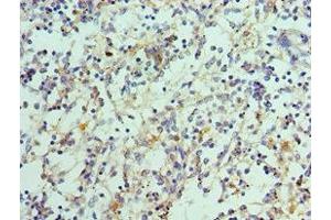 Immunohistochemistry of paraffin-embedded human spleen tissue using ABIN7156850 at dilution of 1:100 (IL-21 anticorps  (AA 25-162))