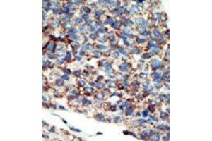 Image no. 1 for anti-Phosphatidylinositol-4-Phosphate 3-Kinase, Catalytic Subunit Type 2 gamma (PIK3C2G) (N-Term) antibody (ABIN360438)