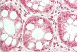 ABIN1019676 (5µg/ml) staining of paraffin embedded Human Colon.
