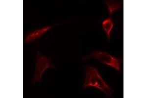 ABIN6278128 staining LOVO cells by IF/ICC. (HSPA14 anticorps)