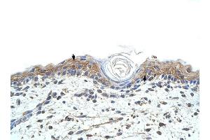 RBMS1 antibody was used for immunohistochemistry at a concentration of 4-8 ug/ml to stain Squamous epithelial cells (arrows) in Human Skin.