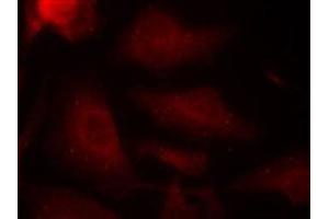 Immunofluorescent staining of methanol-fixed Hela cells using MAPT (phospho S404) polyclonal antibody  at 1:100-1:200 dilution.