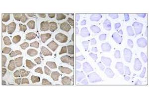 Immunohistochemistry analysis of paraffin-embedded human skeletal muscle tissue using MOT12 Antibody . (SLC16A12 anticorps)