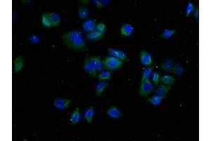 Immunofluorescence staining of PC-3 cells with ABIN7175608 at 1:50, counter-stained with DAPI.