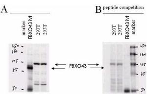 Western blot using FBXO43 polyclonal antibody . (FBXO43 anticorps  (N-Term))