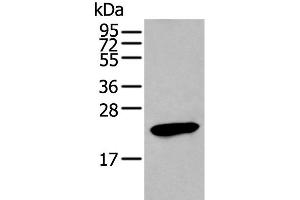 Western blot analysis of Human stomach tissue lysate using GKN1 Polyclonal Antibody at dilution of 1:250 (Gastrokine 1 anticorps)
