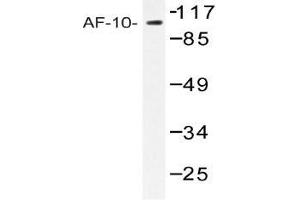 Western blot (WB) analysis of AF-10 antibody in extracts from COLO205 cells. (MLLT10 anticorps)