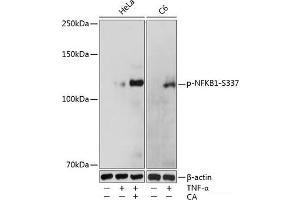 Western blot analysis of extracts of various cell lines using Phospho-NFKB1(S337) Polyclonal Antibody at dilution of 1:1000.