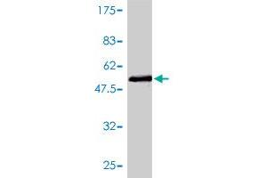 Western Blot detection against Immunogen (47.