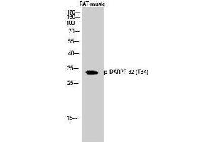Western Blotting (WB) image for anti-Protein Phosphatase 1, Regulatory (Inhibitor) Subunit 1B (PPP1R1B) (pThr34) antibody (ABIN3179790) (DARPP32 anticorps  (pThr34))