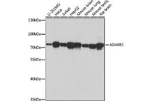 Western blot analysis of extracts of various cell lines, using  antibody (ABIN7265459) at 1:1000 dilution.