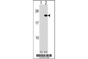 Western blot analysis of ARF5 using rabbit polyclonal ARF5 Antibody using 293 cell lysates (2 ug/lane) either nontransfected (Lane 1) or transiently transfected (Lane 2) with the ARF5 gene. (ARF5 anticorps  (AA 80-108))