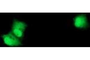 Anti-RPS6KB1 mouse monoclonal antibody (ABIN2454594) immunofluorescent staining of COS7 cells transiently transfected by pCMV6-ENTRY RPS6KB1 (RC217324). (RPS6KB1 anticorps)