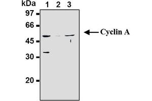 Western Blotting (WB) image for anti-Cyclin A2 (CCNA2) antibody (ABIN567779) (Cyclin A anticorps)
