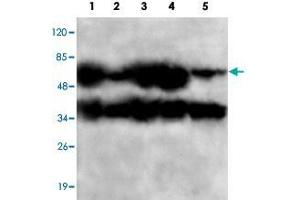 Western blot analysis of PPP2CB monoclonal antibody  at 1:1000 dilution. (PPP2CB anticorps  (C-Term))