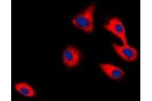 Immunofluorescent analysis of CADM2 staining in HepG2 cells. (CADM2 anticorps)