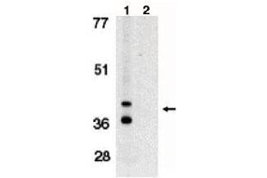 Image no. 1 for anti-BCL2/adenovirus E1B 19kDa Interacting Protein 3-Like (BNIP3L) (AA 77-92) antibody (ABIN264993) (BNIP3L/NIX anticorps  (AA 77-92))