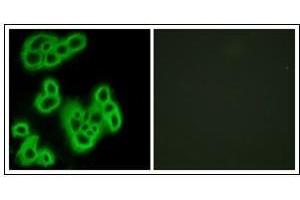 Immunofluorescence analysis of MCF7 cells, using FPR1 Antibody. (FPR1 anticorps)
