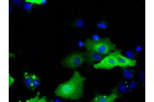 Image no. 4 for anti-Sorting Nexin 9 (SNX9) antibody (ABIN1501044)