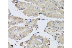 Immunohistochemistry of paraffin-embedded Human stomach using FABP5 Polyclonal Antibody at dilution of 1:100 (40x lens). (FABP5 anticorps)