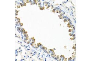 Immunohistochemistry of paraffin-embedded mouse lung using TICAM1 antibody. (TICAM1 anticorps  (AA 20-200))