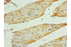 Immunohistochemistry of paraffin-embedded human skeletal muscle tissue using ABIN7171727 at dilution of 1:100 (TRF1 anticorps  (AA 260-439))