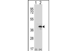 Western blot analysis of ZWINT (arrow) using rabbit polyclonal ZWINT Antibody (Center) (ABIN390639 and ABIN2840941).