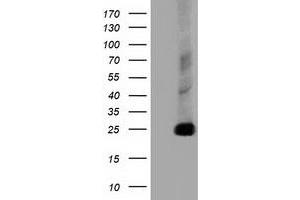 Western Blotting (WB) image for anti-ClpP Caseinolytic Peptidase, ATP-Dependent, Proteolytic Subunit Homolog (E. Coli) (CLPP) antibody (ABIN1497536) (CLPP anticorps)